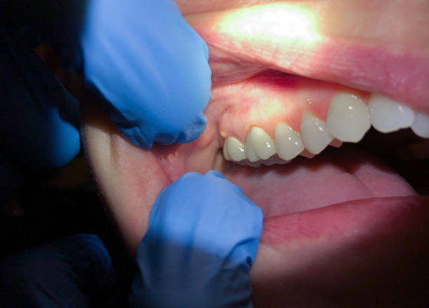 Best Emergency Dental Services for Seniors in Millersville, TN