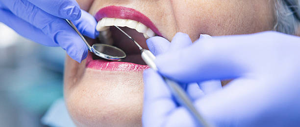 Best Broken or Cracked Tooth Emergency Dentist in Millersville, TN